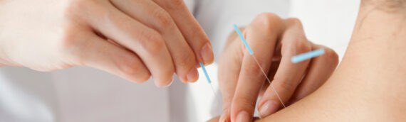 Acupuncture: What Do We Know About It?