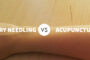 An Image Representing Acupuncture vs. Dry needling