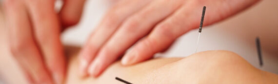 An Overview Of Different Types Of Acupuncture Treatment